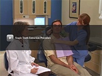 Single Tooth Extraction Procedure video thumbnail image